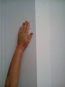 osteon alaquas medicion evolucion hombro