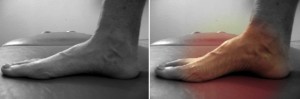 ejercicio de pie corto osteon alaquas carlos lopez cubas