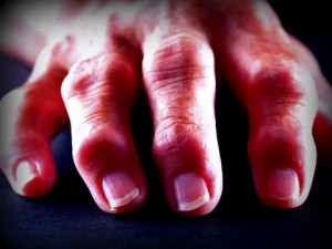 Mano artritis reumatoide manos reumáticas ejercicios osteon