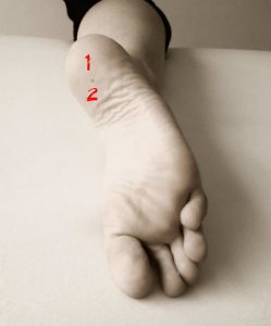 fascitis plantar osteon fasciosis diagnostico