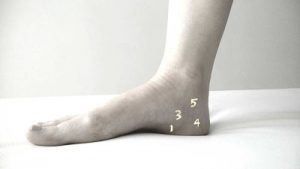 fascitis plantar osteon fasciosis