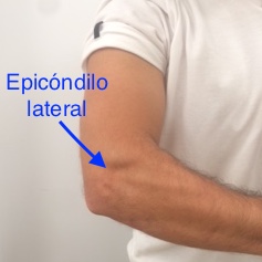 epicondilalgia lateral osteon epicondilitis