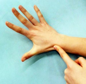 fractura escafoides osteon fisioterapia alaquas