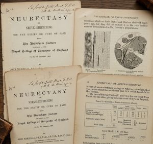 neurectasis neurodinamica