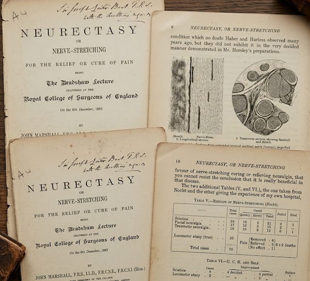 Historia de la Neurodinámica (II)