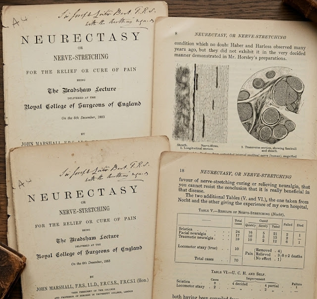 neurectasis neurodinamica